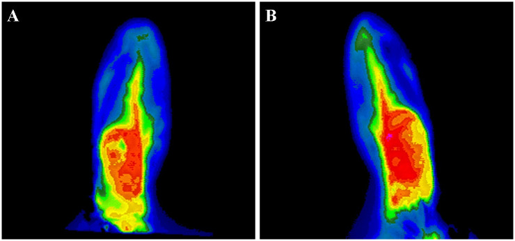 Feasibility of rabbit auricular VX2 tumor model as an experimental model for intra-arterial embolization.