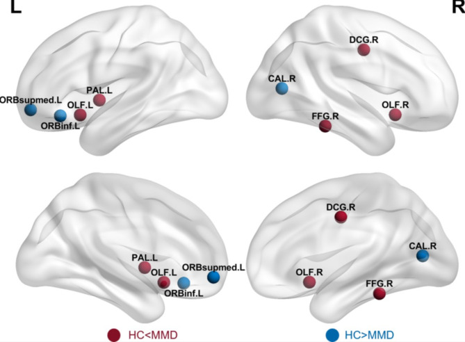 Reorganization of gray matter networks in patients with Moyamoya disease.