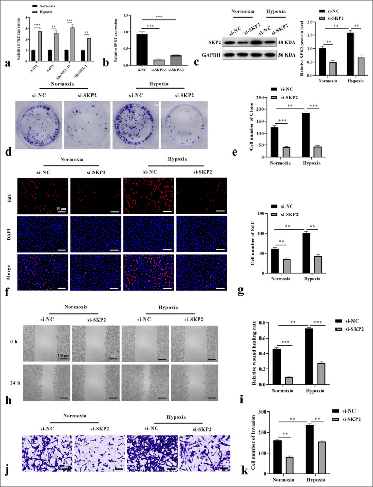 Hypoxia-induced S-phase kinase-interacting protein 2 knockdown repressed the progression of melanoma through extracellular signal-regulated kinase 1/2 pathway.