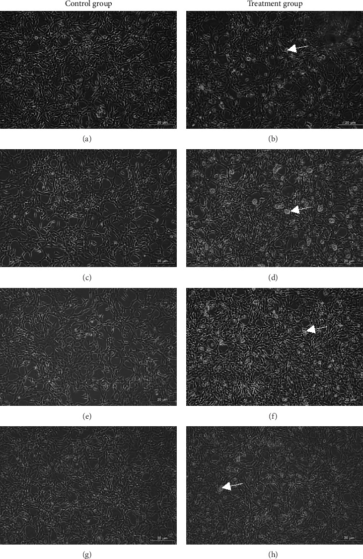 Inhibition of the Transforming Growth Factor-β Signaling Pathway Confers Neuroprotective Effects on Beta-Amyloid-Induced Direct Neurotoxicity and Microglia-Mediated Neuroinflammation.