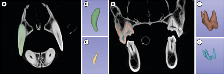 Age estimation using the ratio of dental pulp to tooth volume by CT scan in dogs.