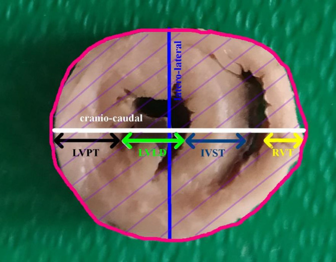 Effects of erythropoietin on cardiac morphometry in exercised male and female adolescent rats.