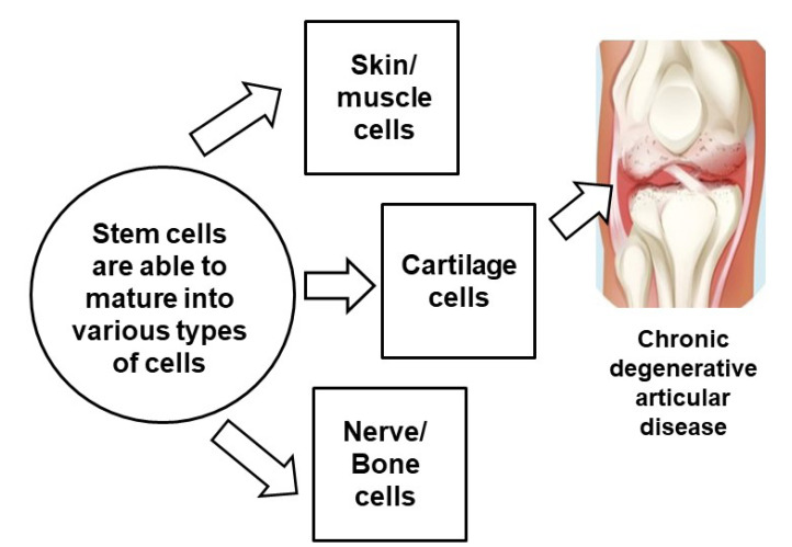 Intra-Articular Injection of Stem Cells for the Regeneration of Knee Joint Cartilage: a Therapeutic Option for Knee Osteoarthritis - a Narrative Review.