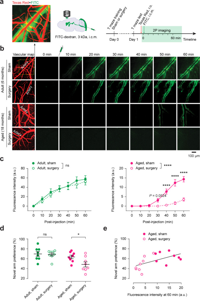 Surgery impairs glymphatic activity and cognitive function in aged mice.