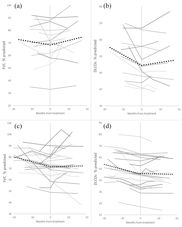 Dynamics of interstitial lung disease following immunosuppressive treatment differ between antisynthetase syndrome and systemic sclerosis.