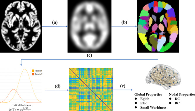 Reorganization of gray matter networks in patients with Moyamoya disease.