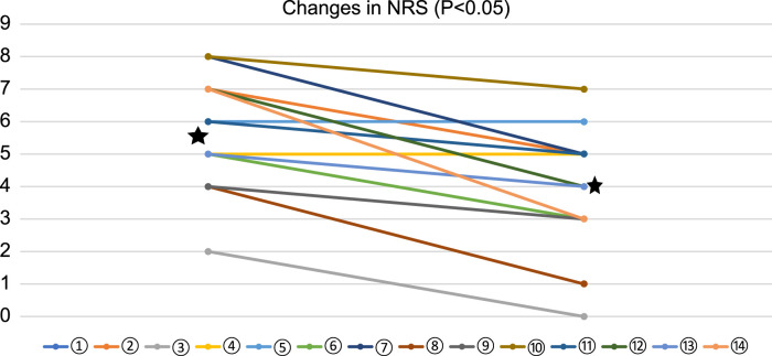 Enhancing Duloxetine With Mirogabalin for Treating Taxane-Induced Peripheral Neuropathy in Advanced Lung Cancer.