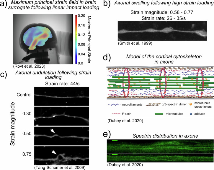 Cellular mechanisms of traumatic brain injury.