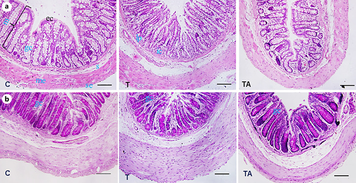 Endoplasmic Reticular Stress and Pathogenesis of Experimental Colitis: Mechanism of Action of 5-Amino Salicylic Acid.