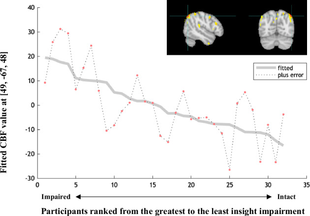 Impaired insight in schizophrenia is associated with higher frontoparietal cerebral blood flow: an arterial spin labeling study.