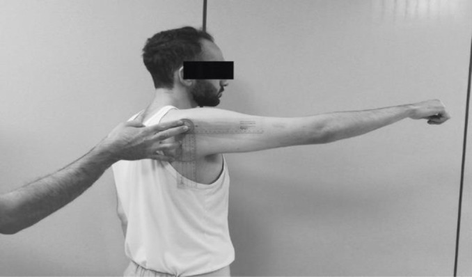The Persian Version of Constant-murley Score in Patients with Rotator Cuff Tears: Reliability and Validity.