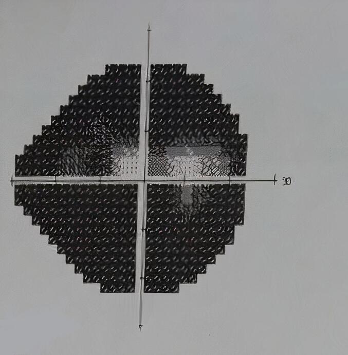 Bilateral optic neuritis as an atypical presentation of juvenile Behcet syndrome: A case report