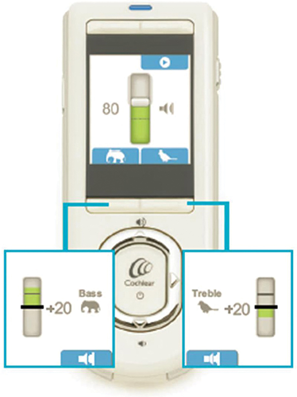 Feasibility of Self-Programming of the Speech Processor Via Remote Assistant Fitting in Experienced Cochlear Implant Users.