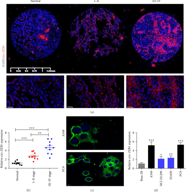 circ-ZEB1 Enhances NSCLC Metastasis and Proliferation by Modulating the miR-491-5p/EIF5A Axis.
