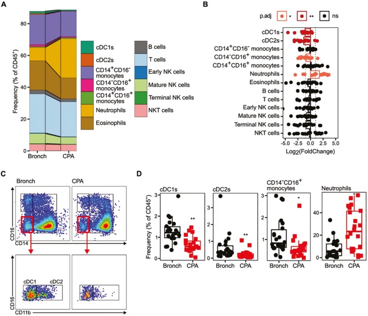 Dendritic cell dysfunction, including impaired IL-12 production, is associated with chronic pulmonary aspergillosis.