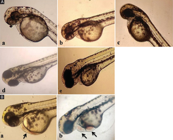 Cardiac physiological changes induced by cardiovascular drugs from different chemical classes in zebrafish mirrored in mice: A predictive tool for comprehensive risk assessment.