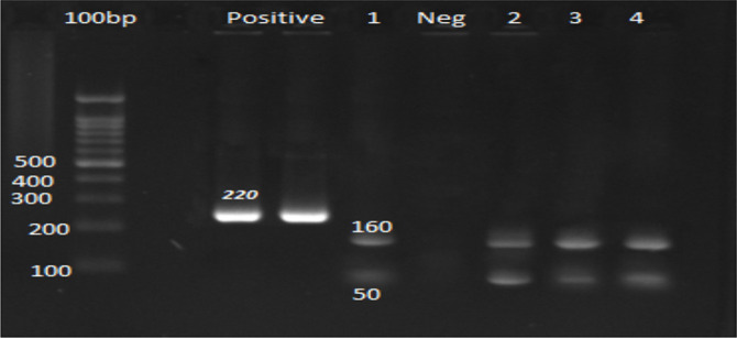 Serological Evaluation and Molecular Genotyping of <i>Toxoplasma gondii</i> in Pregnant Women in Meshkin-Shahr District, Northwestern Iran.