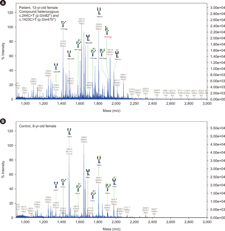 The First Korean Case of <i>MAN1B1</i>-Congenital Disorder of Glycosylation Diagnosed Using Whole-Exome Sequencing and Matrix-Assisted Laser Desorption Ionization Time-of-Flight Mass Spectrometry.