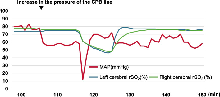 Acute aortic dissection during minimally invasive cardiac surgery: a case report.