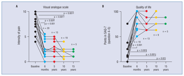 Spinal cord stimulation in the treatment of refractory angina pectoris: 25-year clinical experience at a single center.