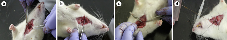Inactivation of Notch1-TGF-β-Smads Signaling Pathway by Atorvastatin Improves Cardiac Function and Hemodynamic Performance in Acute Myocardial Infarction Rats.