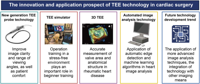 Transesophageal echocardiography: Revolutionizing perioperative cardiac care.