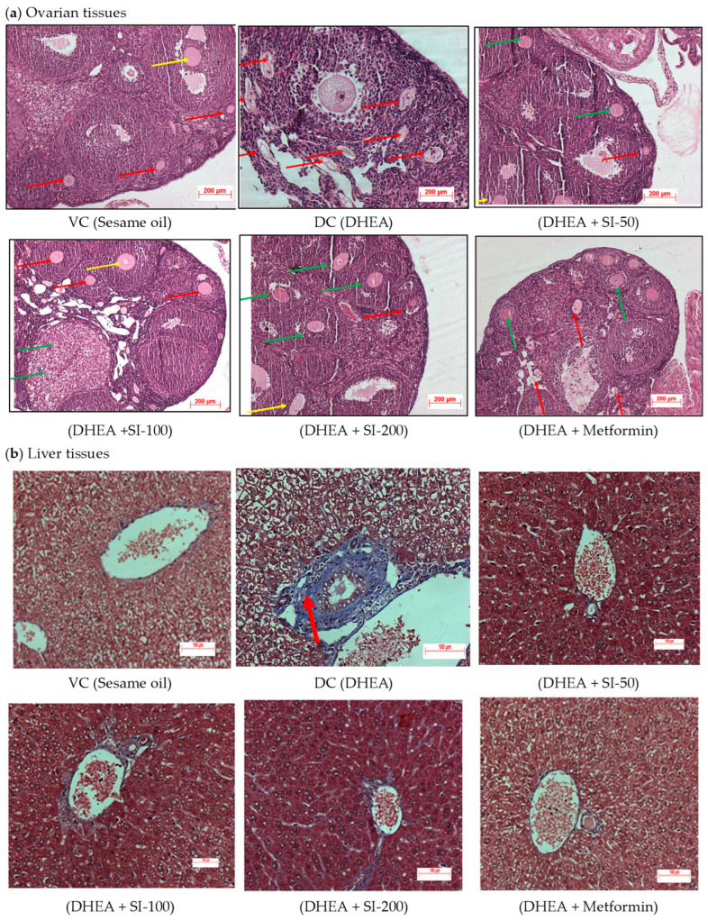 Correction: Yamarthi et al. <i>Sepia pharaonis</i> Ink Mitigates Dehydroepiandrosterone-Induced Insulin Resistance in Mouse Model of Polycystic Ovarian Syndrome. <i>Pathophysiology</i> 2024, <i>31</i>, 408-419.