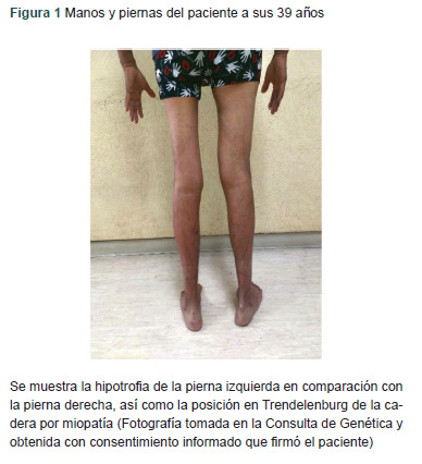[Autosomal recessive limb-girdle muscular dystrophy-10. Case report].