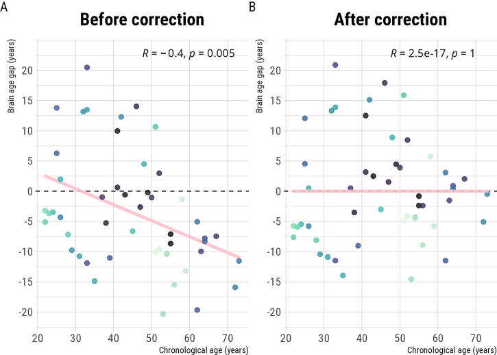 Structural Magnetic Resonance Imaging Brain Age Investigation in Athletes with Persistent Postconcussion Syndrome.