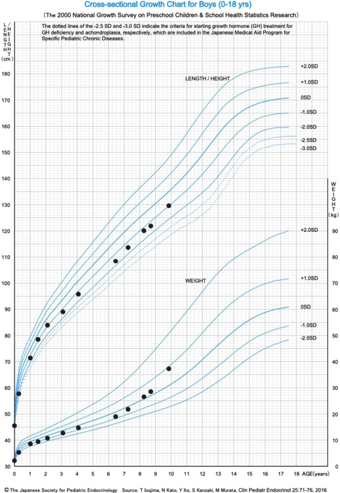 Idiopathic infantile hypercalcemia with a <i>CYP24A1</i> variant triggered by vitamin D supplementation in fortified milk: A case report.