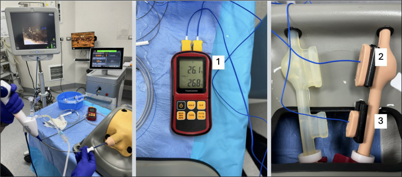 Renal and ureteral temperatures changes during ureteroscopic pulsed thulium: YAG laser lithotripsy: an <i>in vitro</i> analysis.
