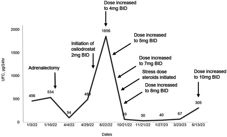 A Case of Severe Cushing Syndrome due to Metastatic Adrenocortical Carcinoma Treated With Osilodrostat