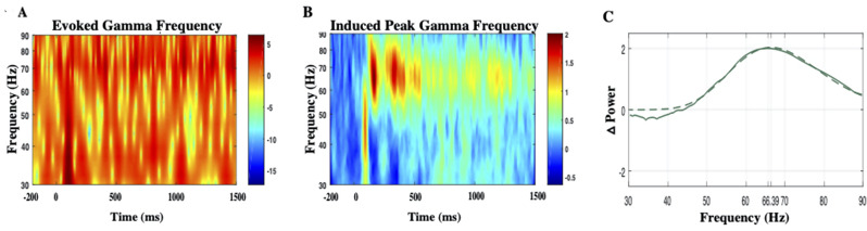Age predicts peak gamma frequency and N1 amplitude of visual evoked potential.