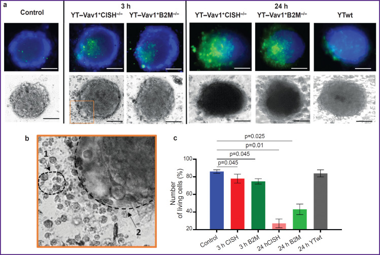 Efficacy Evaluation of "Enhanced" Natural Killers with <i>CISH</i> and <i>B2M</i> Knockouts on Viability and Metabolic Status of 3D Glioblastoma Spheroid Cells in Patients.