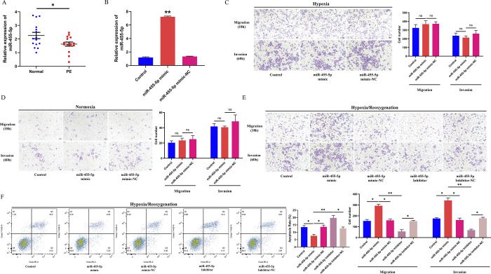 Short communication: Upregulation of hypoxia/reoxygenation-induced Shc3 by downregulated miR-455-5p, suppresses trophoblast invasion and is associated with placental inflammation and angiogenesis in preeclampsia.