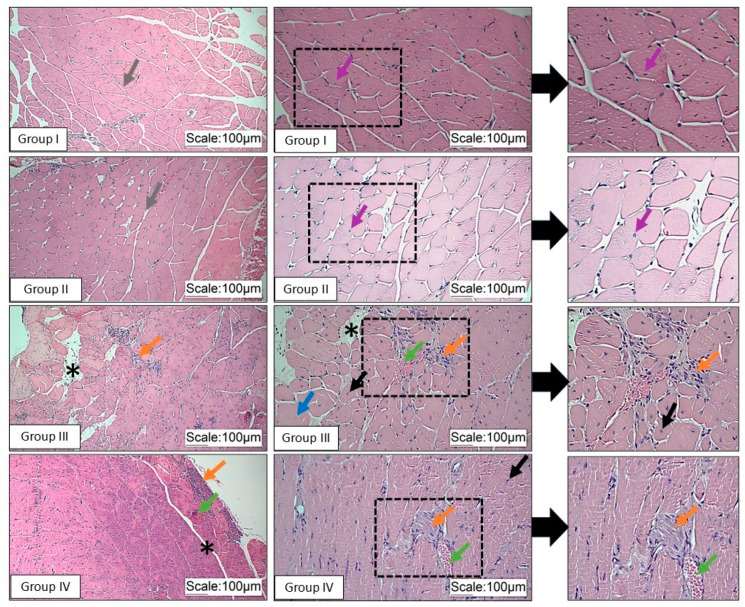 Evaluation of Creatine Monohydrate Supplementation on the Gastrocnemius Muscle of Mice with Muscular Dystrophy: A Preliminary Study.
