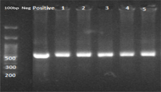 Serological Evaluation and Molecular Genotyping of <i>Toxoplasma gondii</i> in Pregnant Women in Meshkin-Shahr District, Northwestern Iran.