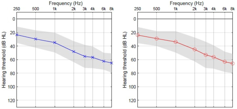 Two Tests for Quantifying Aided Hearing at Low- and High-Input Levels.