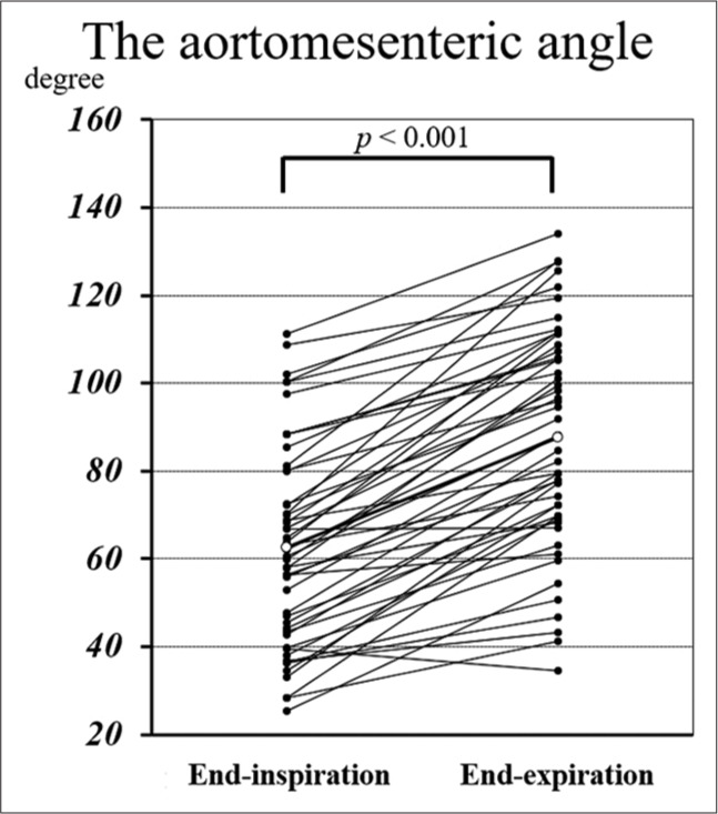 Aortomesenteric angle: A contrast-enhanced computed tomography analysis of respiratory phase and visceral fat impact.