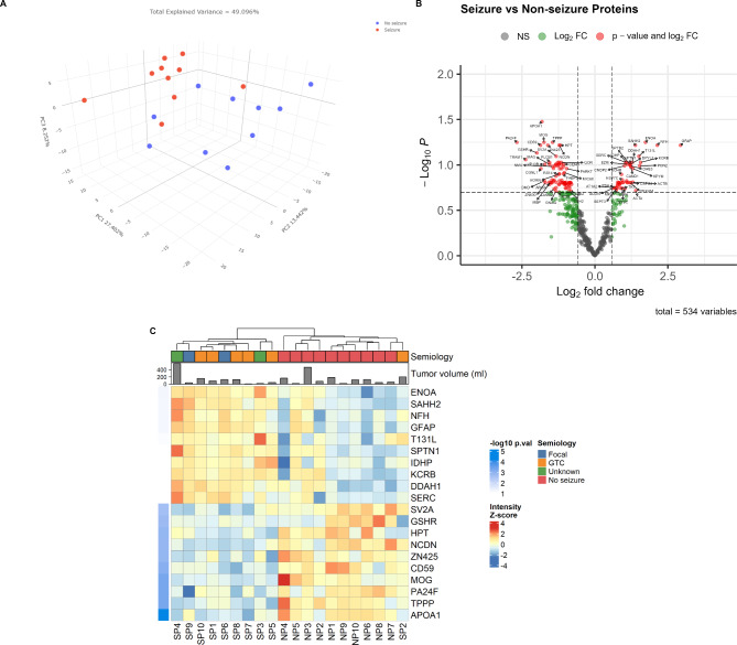 Comparative proteomic analysis of astrocytoma tissues from patients with and without seizures.