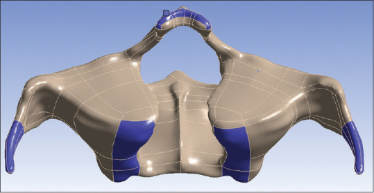 Biomechanical Behaviour of Quad Zygoma Technique Using a Smooth Body Zygomatic Implant and Angled Abutments - An <i>In Vitro</i> Study.