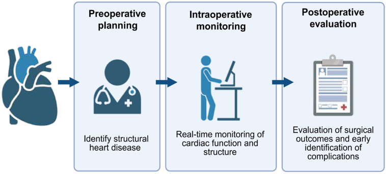 Transesophageal echocardiography: Revolutionizing perioperative cardiac care.