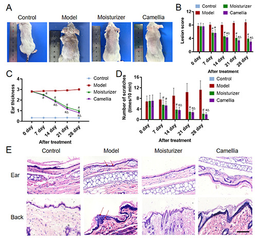 Restorative effects of camellia oil on the skin-barrier function in a model of DNCB-induced atopic dermatitis.