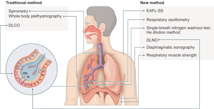 Beyond the Spirometry: New Diagnostic Modalities in Chronic Obstructive Pulmonary Disease.
