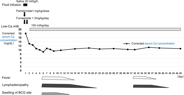 Idiopathic infantile hypercalcemia with a <i>CYP24A1</i> variant triggered by vitamin D supplementation in fortified milk: A case report.