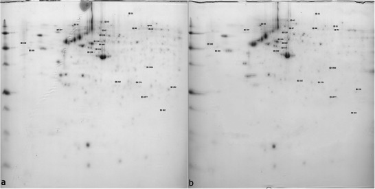 Proteomic Analysis of Fibroblasts Exposed to Resin Composite Release.