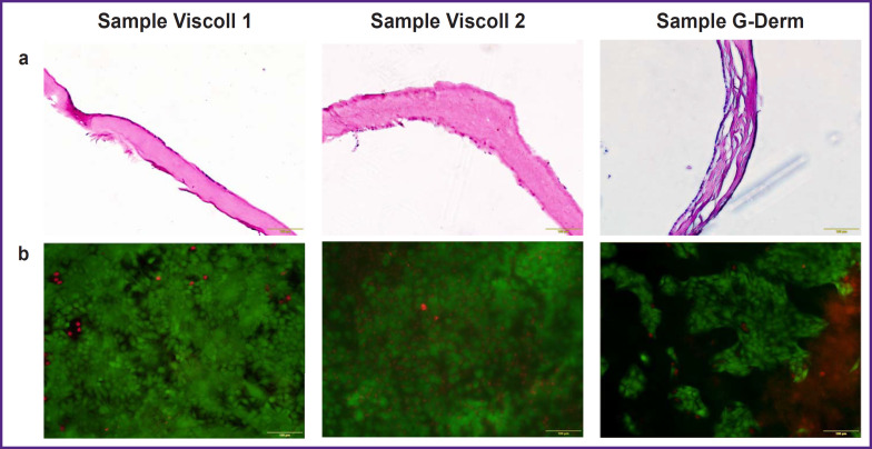 The Development of Inner Ear Membrane Analog for Experimental Otorhinolaryngology.