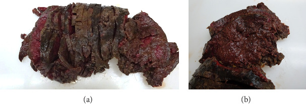A Case of Atraumatic Splenic Rupture Due to T-Cell/Histiocyte-Rich Large B-Cell Lymphoma and a Potential Role for Massive Transfusion Protocol.