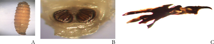Urogenital Myiasis in a 5 Years Old Boy: A Case Report.