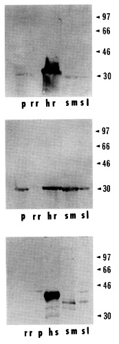Immunohistochemistry of carbonic anhydrases I, II and VI in the rat lingual serous salivary glands of von Ebner.